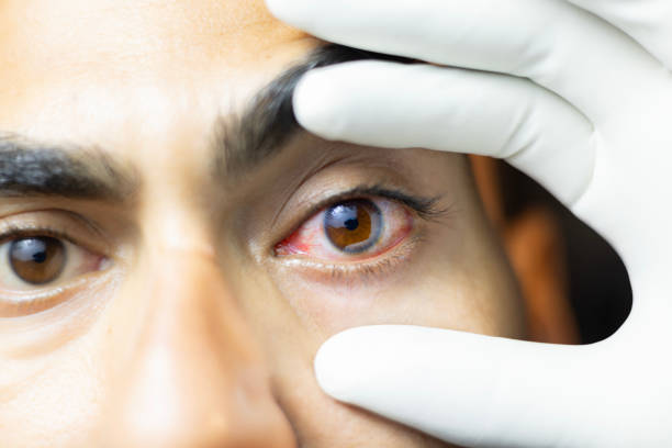 Winter Eye Strain and Dryness: UAE Doctors Issue Warning