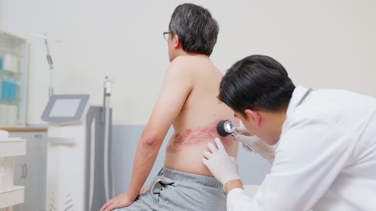 Shingles Risk After 50: Why Self-Protection Matters More Than Ever