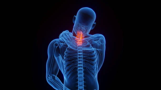 Rising cases of cervical spondylitis among youth linked to modern lifestyles