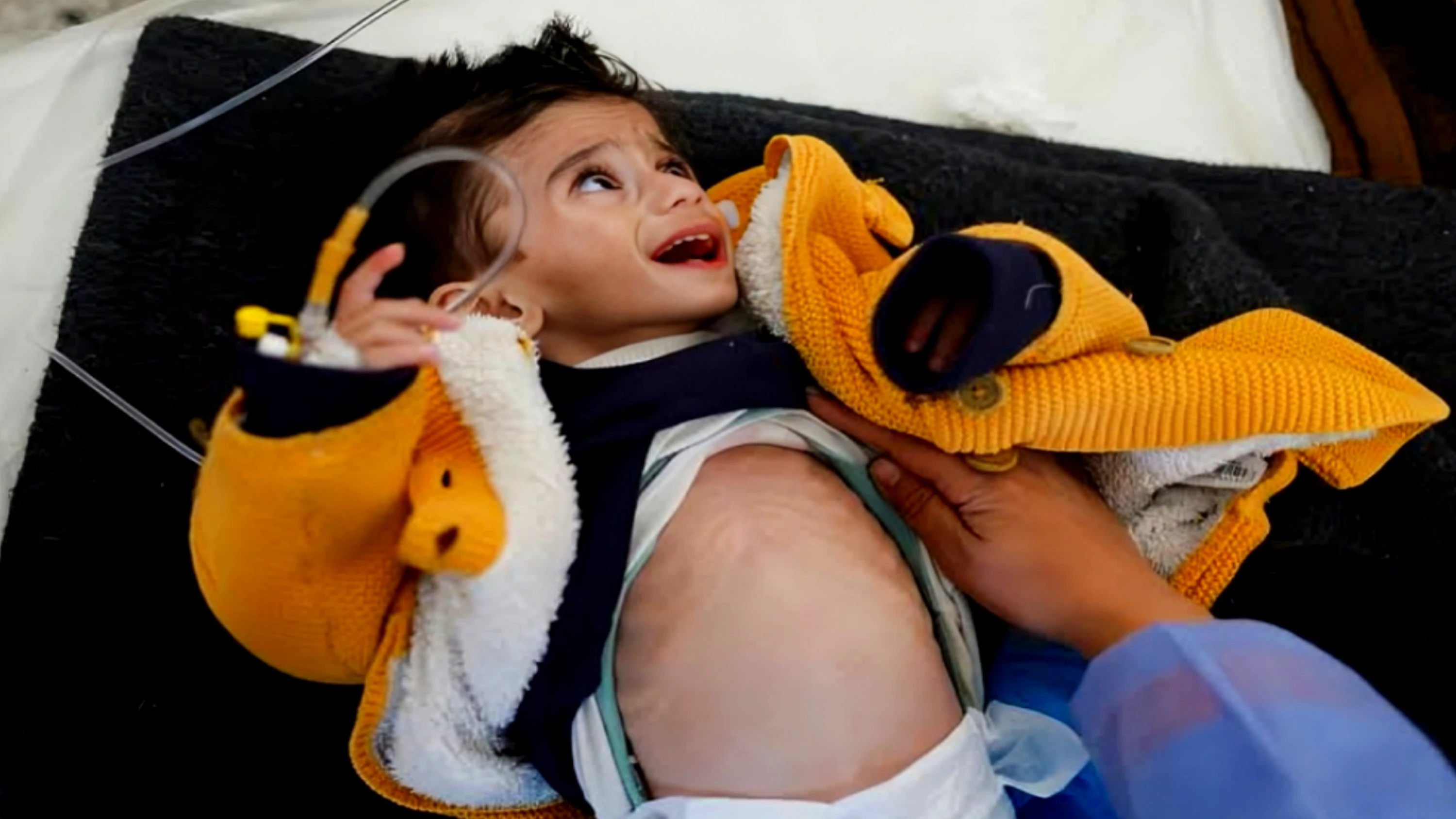 A Skeleton Covered in Skin’: Aid Workers Describe Gaza’s Starving Children Amid Famine Threat