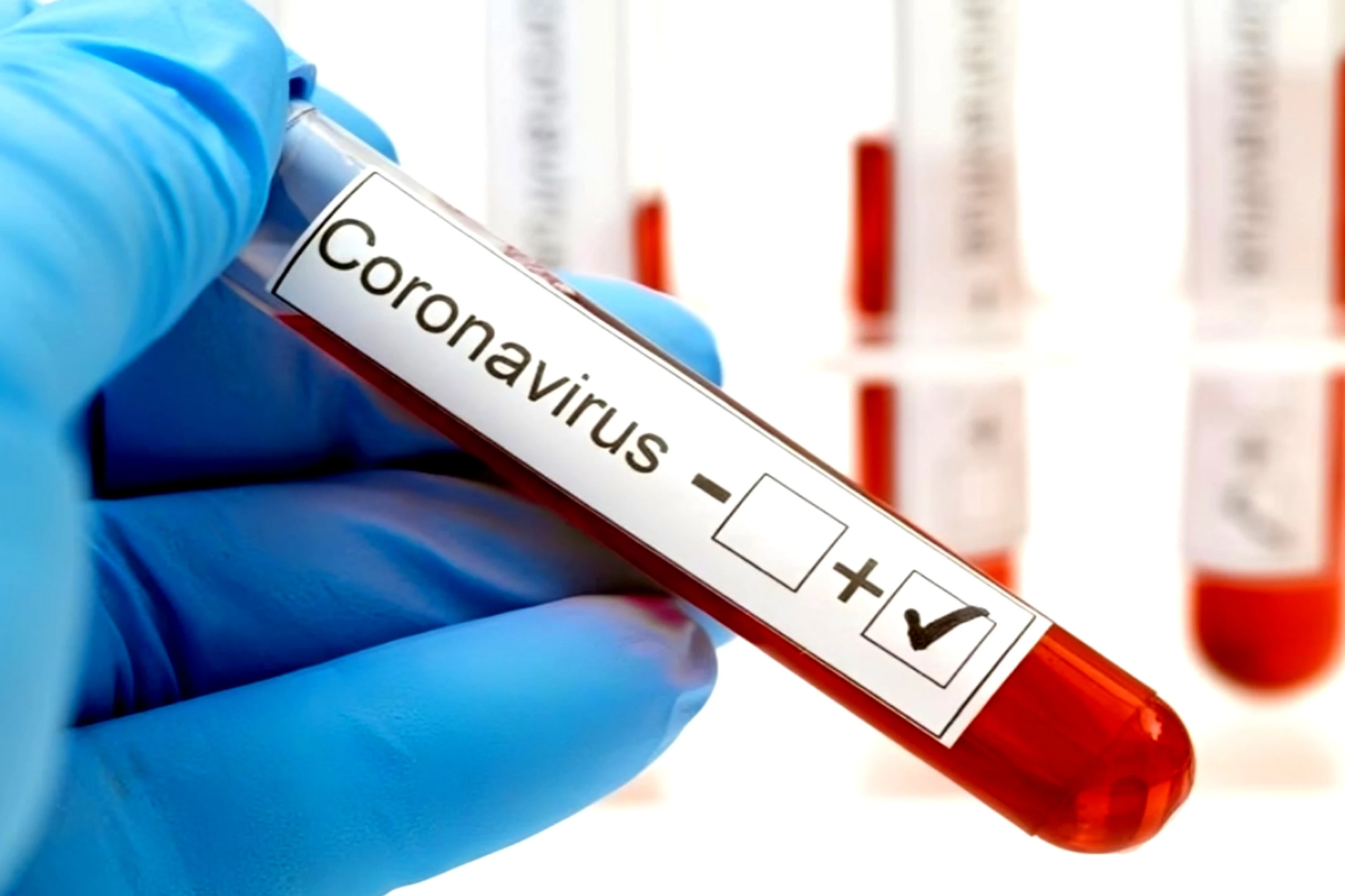 India reports 4,302 active covid-19 cases; new variant nb.1.8.1 under surveillance