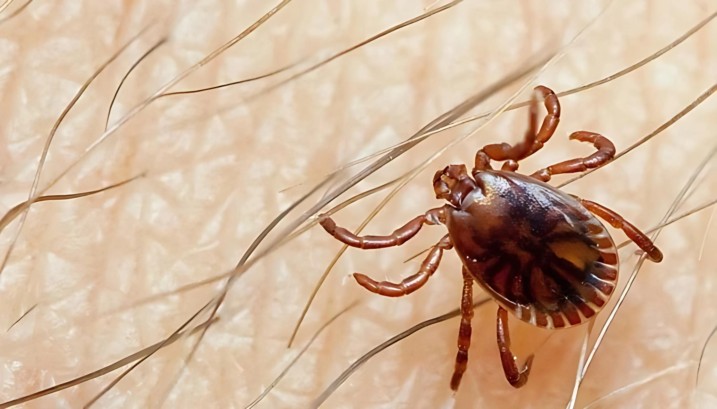 Congo Virus Kills One in Sindh, Two Cases Found in KP