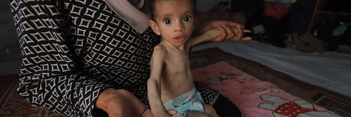 Unicef warns of exploding malnutrition crisis among gaza’s children amid israeli siege