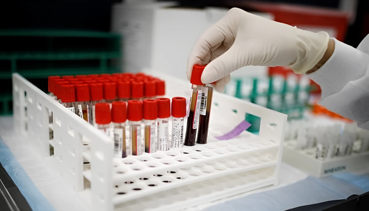 Rare Blood Group ‘Gwada Negative’ Identified by French Researchers