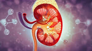 Kidney stone prevention starts with these simple daily habits