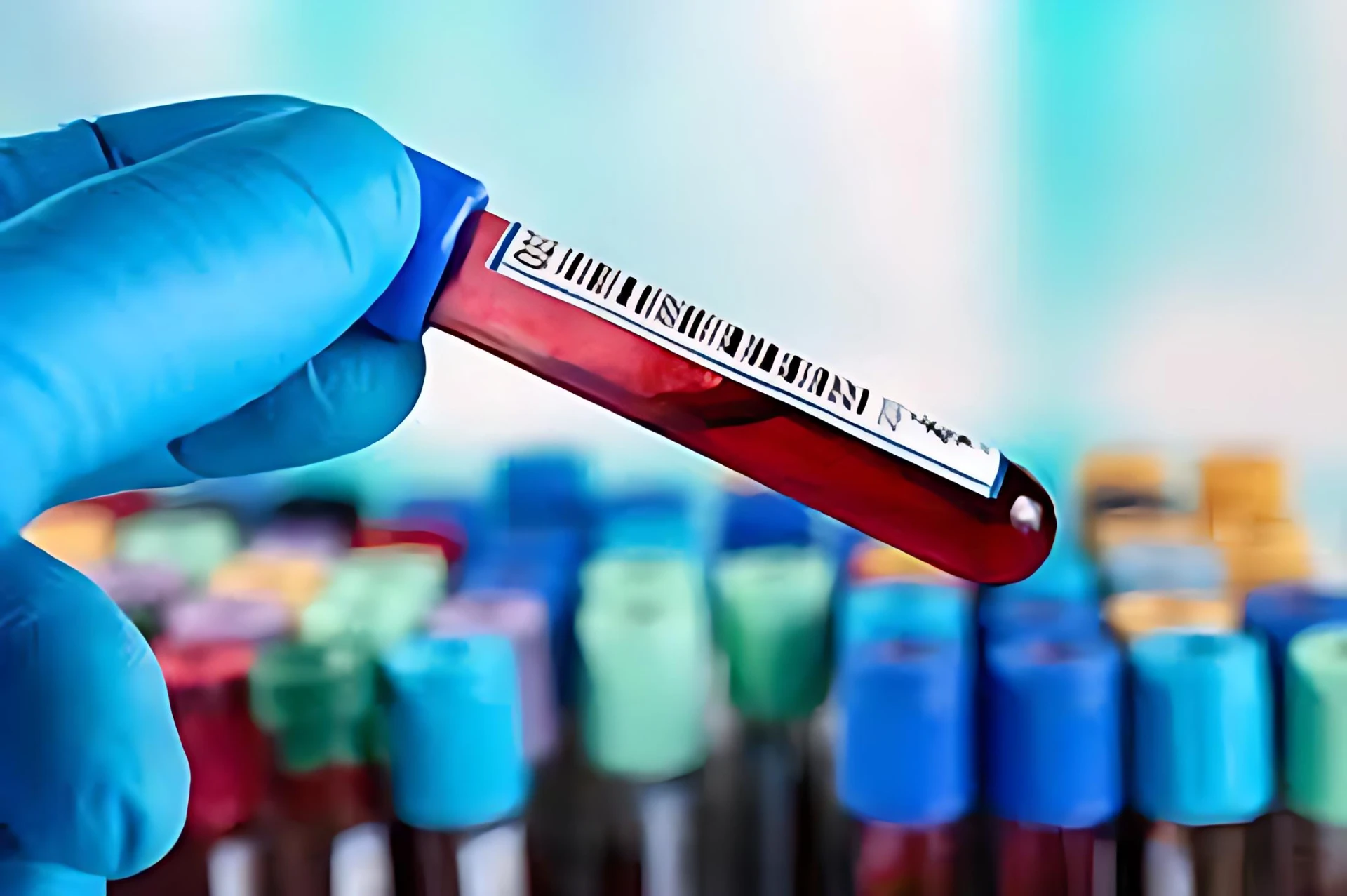 Alzheimer’s progression may be predicted by common blood test