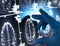 Abu Dhabi Opens First Early Detection Alzheimer’s Centre