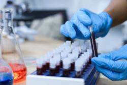 Gaza Hospitals Near Collapse as Over Half of Cancer Medicines Run Out