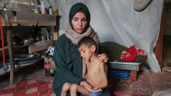 60,000 Gaza Children Suffer Malnutrition Amid Israeli Blockade