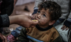 Gaza’s Children Near Death as Starvation Deepens Under Israeli Blockade