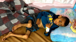 Children Malnourished, Hospitals Collapsing After Two Months of Aid Blockade