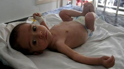 UN Raises Alarm Over Surge in Child Malnutrition in Gaza