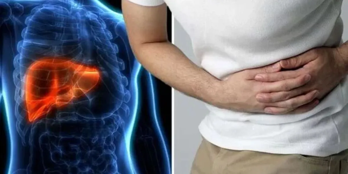 Jaundice With Abdominal Pain Could Indicate Serious Bile Obstruction