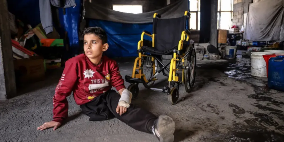 UN: One in Five Amputees in Gaza is a Child Amid Medical Shortage