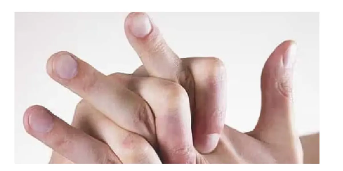 Does Knuckle Cracking Cause Arthritis? Scientists Reveal The Truth