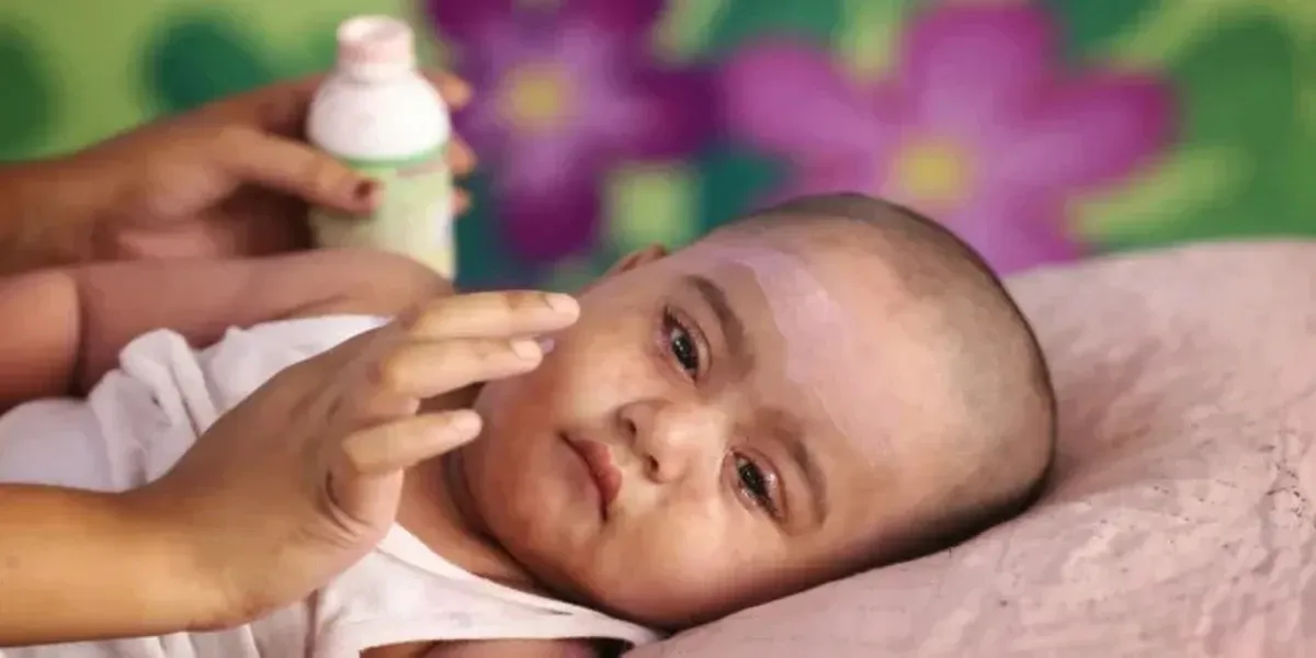 Bangladesh Measles Outbreak Death Toll Reaches 885 as 5 More Children Die in 24 Hours