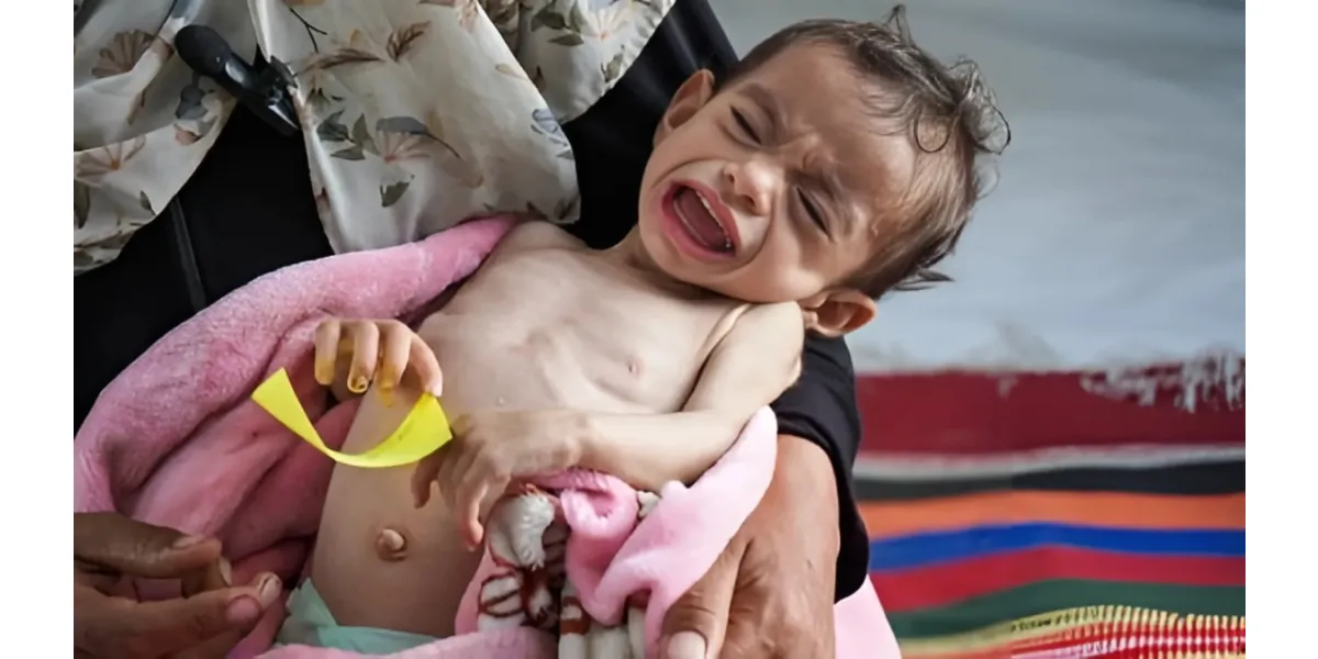 Gaza: At Least 66 Children Dead from Malnutrition as Israeli Siege Chokes Aid Access