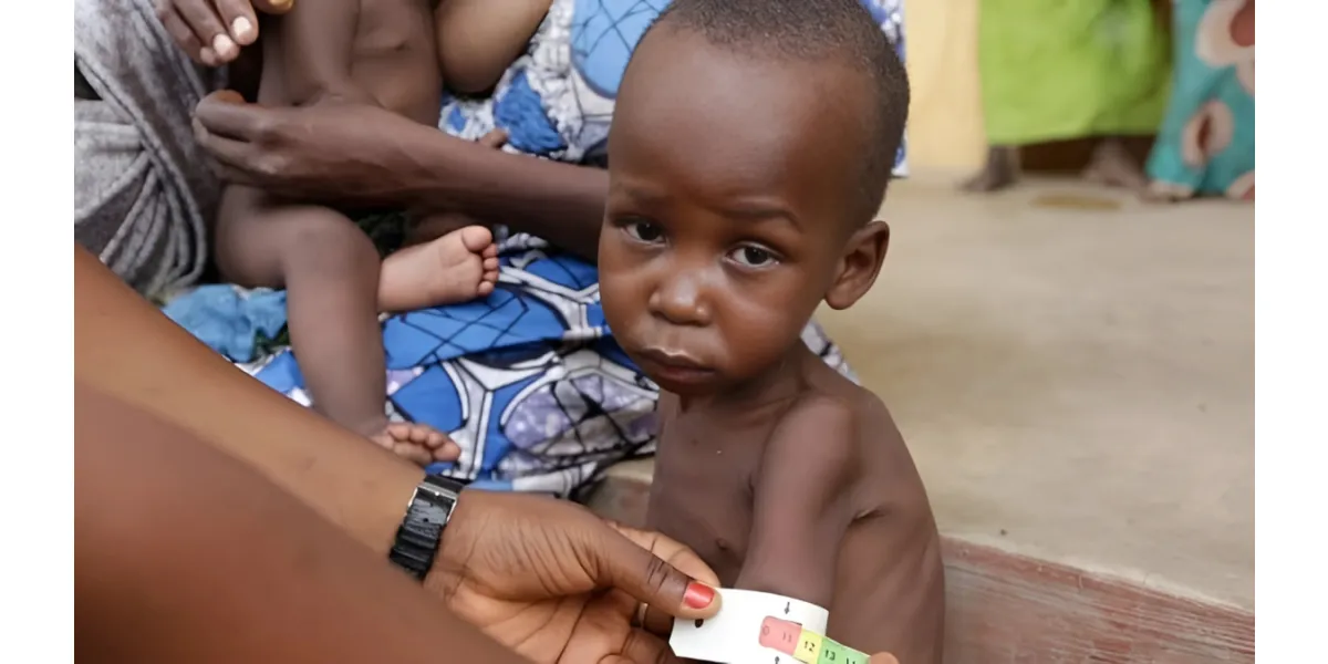 Over 650 Children Die from Malnutrition in Northern Nigeria Amid Aid Cuts, MSF Reports